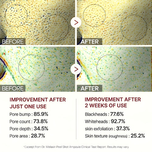 Rice Shot Ampoule Last Minute Offer (Copy)