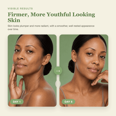 The Korean "Filler in a Bottle" Stick PDRN + Volufiline