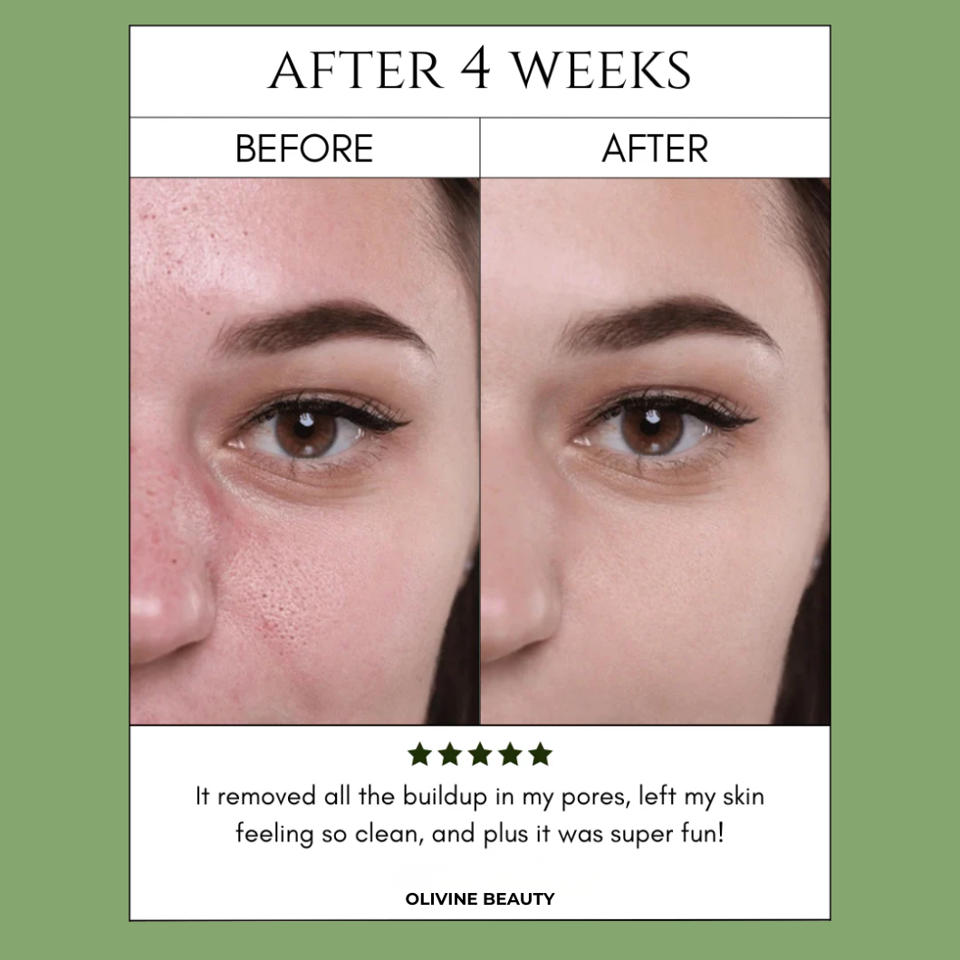 Offer: Holy Basil Bubble Mask