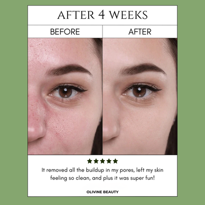 Holy Basil Bubble Mask