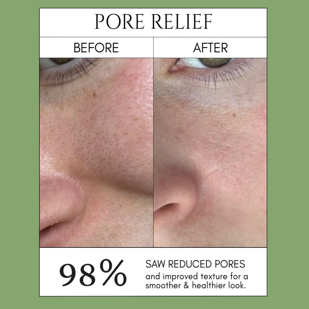 Offer: Holy Basil Bubble Mask