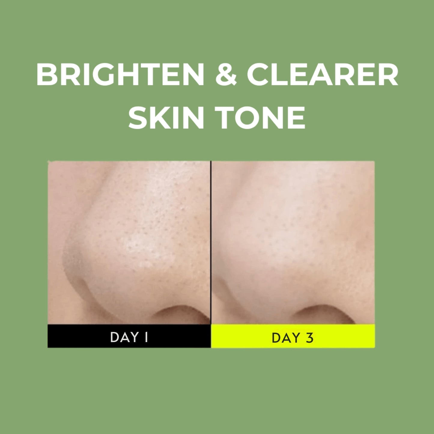 Beplain Skin Detox Trio for Filter Skin