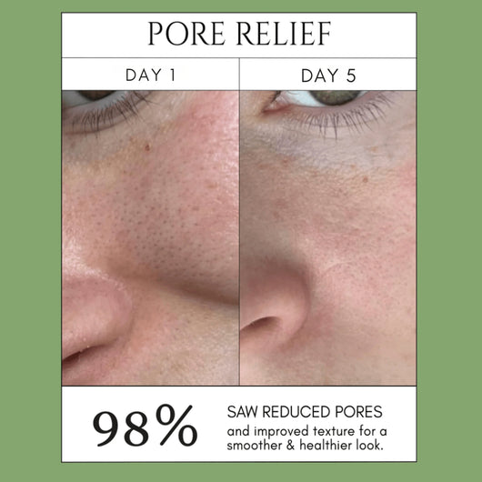 Olivine Beauty Holy Basil Bubble Mask product image