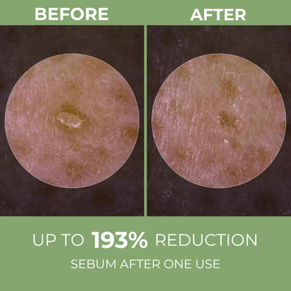 Rice Shot Ampoule Last Minute Offer