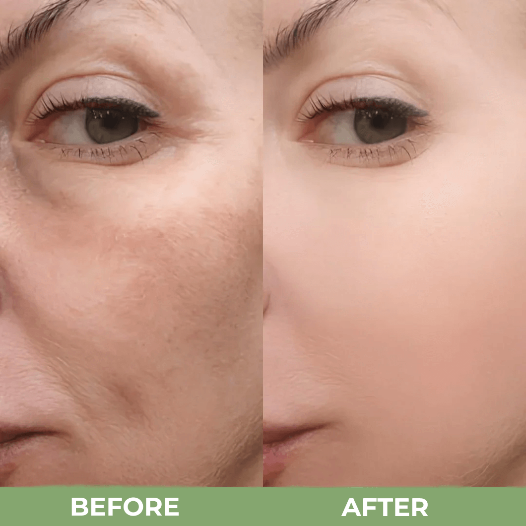 Rice Peel Shot Ampoule™ (40% OFF)