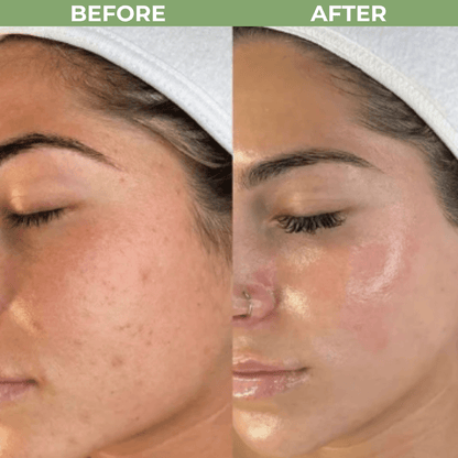 Rice Shot Ampoule Last Minute Offer