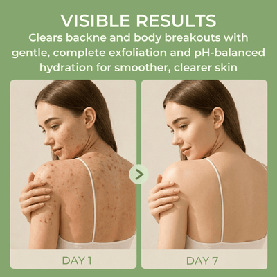 7-day visible results comparison of back acne clearing using Olivine Beauty body cleanser.