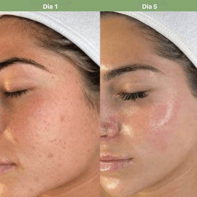 Ampolla Exfoliante de Arroz