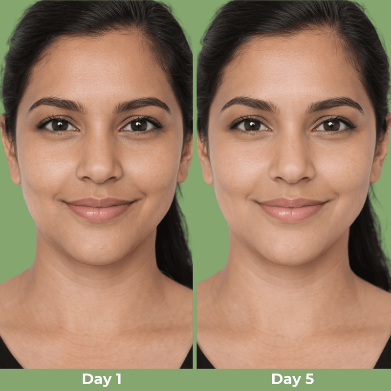 Before and after comparison showing improved jawline appearance after using Cactox V-Lifting Mewing Band