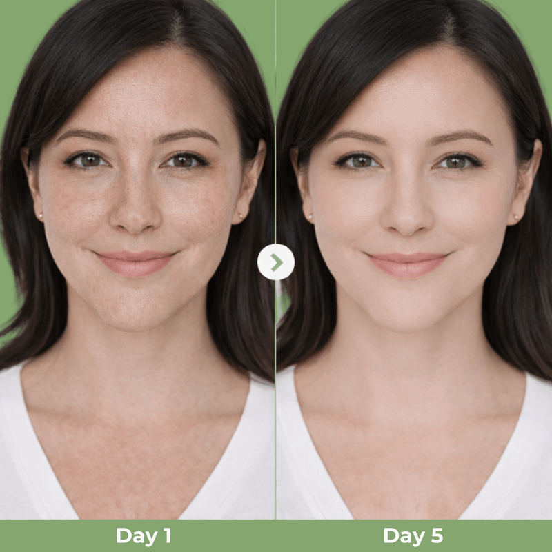 Before and after skin clarity comparison showing refined pores and smoother skin texture