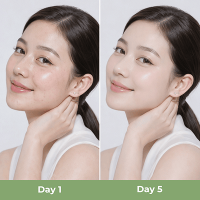 before and after skin showing clearer pores and smoother texture after toner use