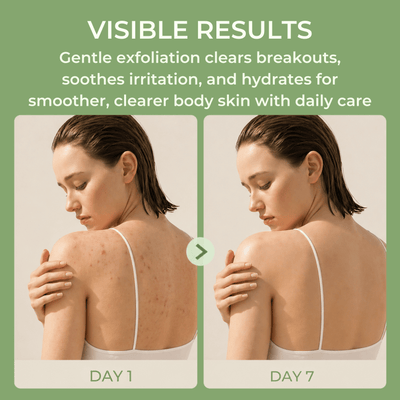 Before and after body acne showing smoother and clearer-looking skin over time