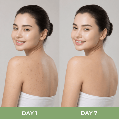 Day 1 and Day 7 body skin comparison showing smoother texture and improved clarity