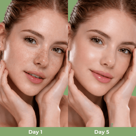 Day 1 vs Day 5 blackhead comparison showing smoother clearer nose pores after using Olivine Beauty Cactox Nose Pore Pack