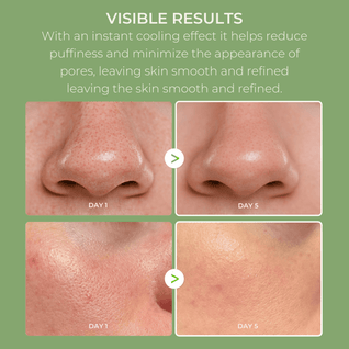 Cactox Pore Relief Multi Balm