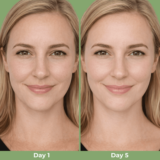 Day 1 and Day 5 comparison showing improved facial contour appearance with Olivine Beauty Cactox V-Lifting Mewing Band