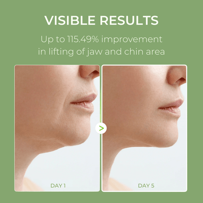 Before and after jawline appearance comparison showing results from using Olivine Beauty Cactox V-Lifting Mewing Band