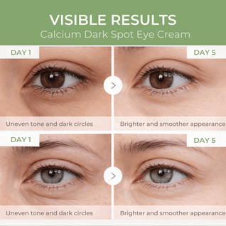 Cemenrete Calcium Dark Spot Eye Cream
