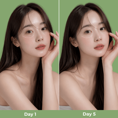 Before and after appearance of under-eye area showing smoother looking skin with Calcium Intense Ampoule Plus