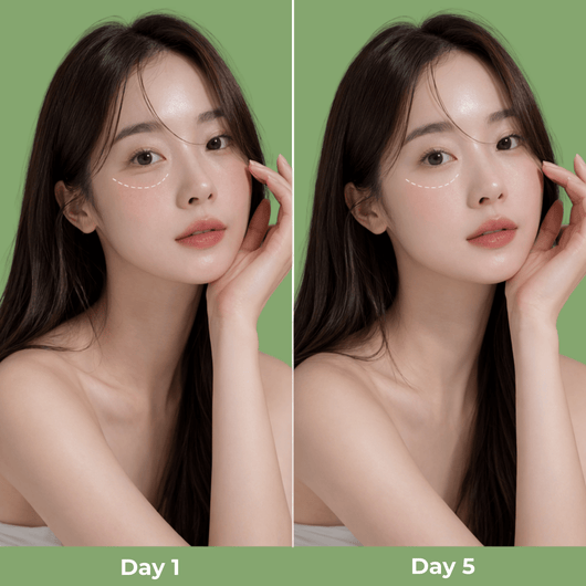 Before and after appearance of under-eye area showing smoother looking skin with Calcium Intense Ampoule Plus