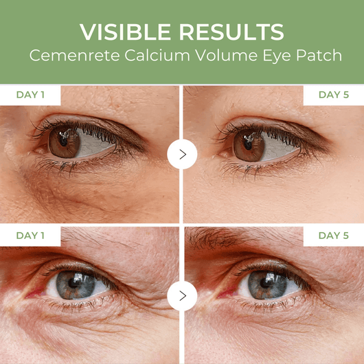 Olivine Beauty Cemenrete Calcium Volume Eye Patch visible results comparison Day 1 vs Day 5 under eye wrinkles and puffiness