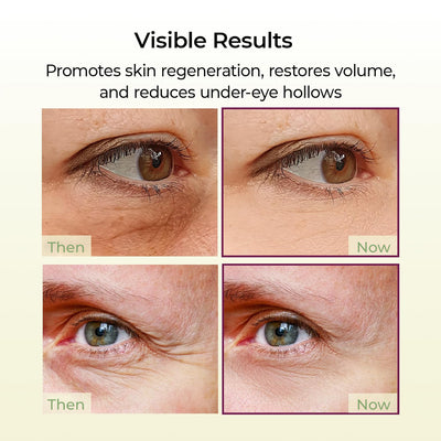 Before and after results showing smoother under eye skin using Olivine Beauty calcium volume multi balm stick