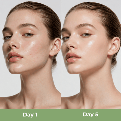 Close up before and after skin showing reduced texture and improved clarity