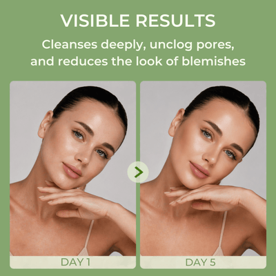 Before and after skin showing improved clarity and smoother texture day 1 vs day 5