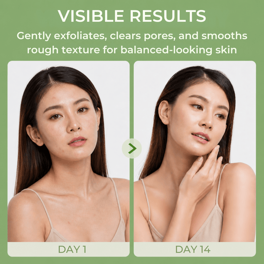 Olivine Beauty cleansing bar showing gradual improvement in skin clarity and smoother texture over consistent use