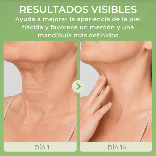 Olivine Beauty comparación del cuello y mandíbula mostrando una apariencia más firme y suave.