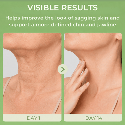Olivine Beauty neck and jawline comparison showing smoother-looking skin appearance over time.
