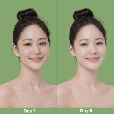Olivine Beauty skincare results day 1 vs day 5 showing smoother skin and less visible pores