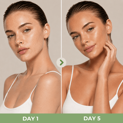 Close up Day 1 and Day 5 bronzed skin comparison using CYKLAR Self Tanning Milky Essence