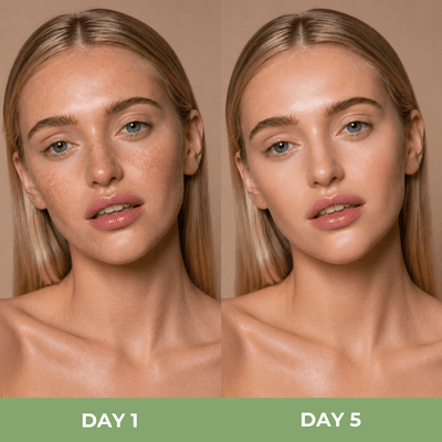 Close up comparison showing smoother and more radiant skin after using toner pads