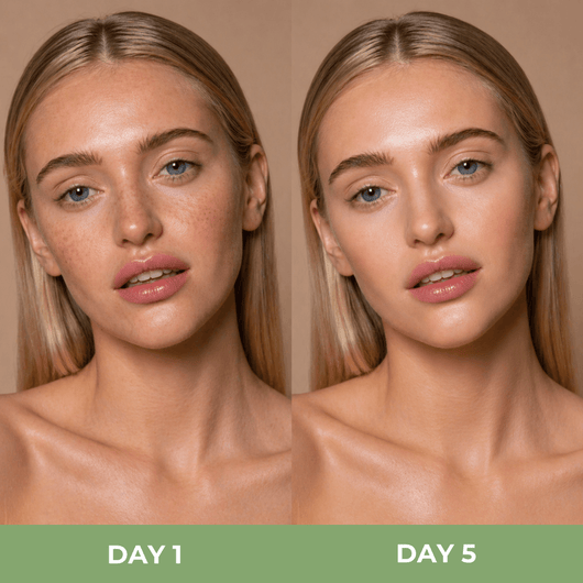 Close up comparison showing smoother and more radiant skin after using toner pads