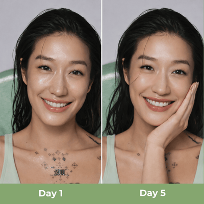 Day 1 vs day 5 results showing smoother more hydrated glowing skin