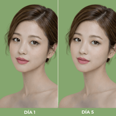 Comparación día 1 y día 5 usando Olivine Beauty crema para ojeras y manchas oscuras