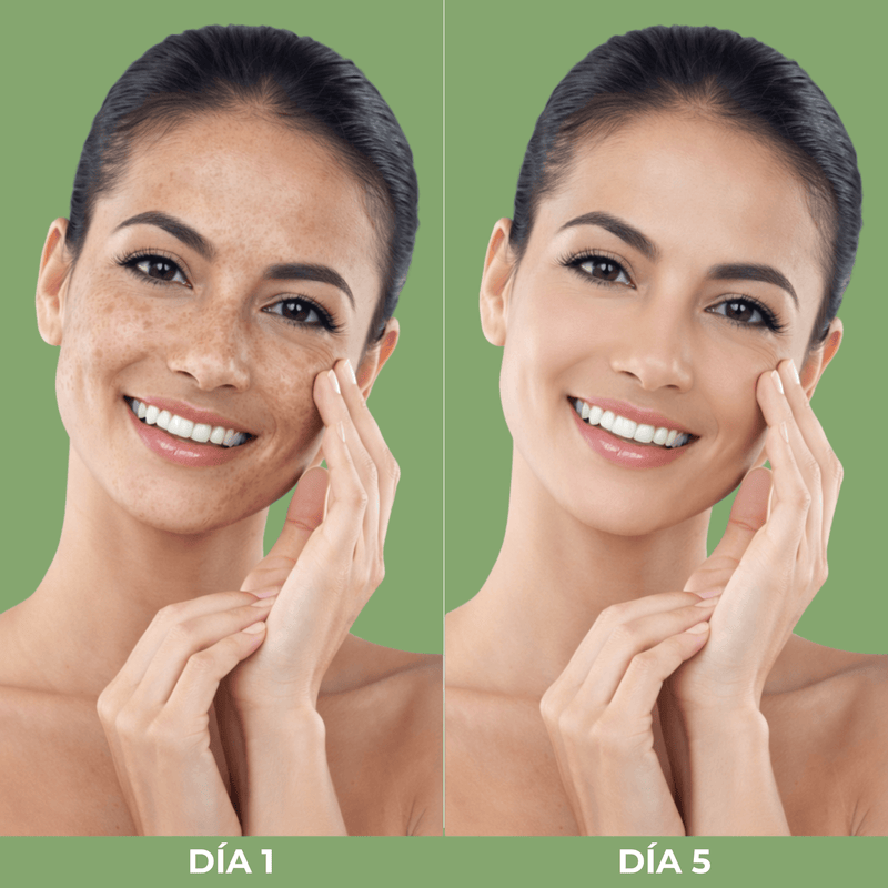 Comparación Día 1 y Día 5 mostrando mejora visible en manchas oscuras y luminosidad de la piel con Olivine Beauty.