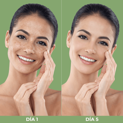 Comparación Día 1 y Día 5 mostrando mejora visible en manchas oscuras y luminosidad de la piel con Olivine Beauty.