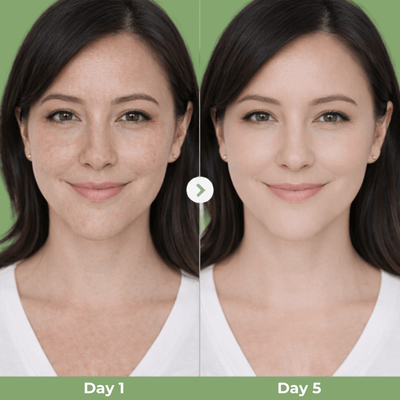 Olivine Beauty Dubai Peptide Clay Mask visible skin texture improvement day 1 vs day 5 results