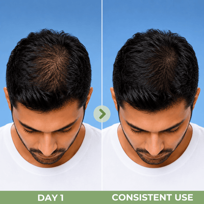 Illustrative hair density comparison showing reduced visible thinning and fuller-looking hair with consistent use of Olivine Beauty Hair Growth Serum.