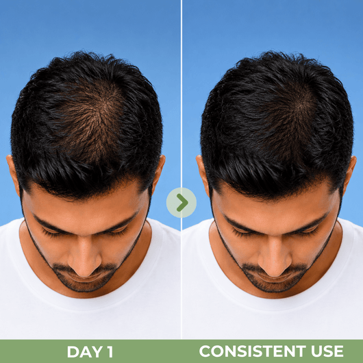 Illustrative hair density comparison showing reduced visible thinning and fuller-looking hair with consistent use of Olivine Beauty Hair Growth Serum.
