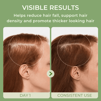 Illustrative comparison showing fuller-looking hair and improved hair density with consistent use of Olivine Beauty Hair Growth Serum.