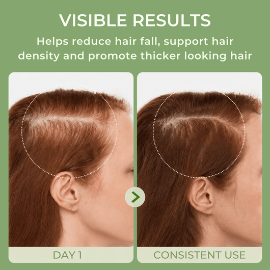 Illustrative comparison showing fuller-looking hair and improved hair density with consistent use of Olivine Beauty Hair Growth Serum.