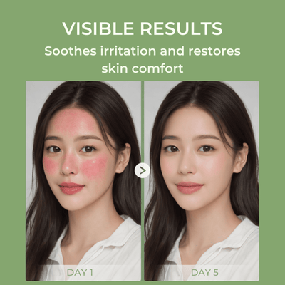 Olivine Beauty calming cream before and after showing reduced redness and smoother skin appearance