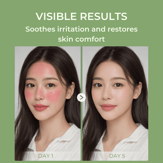 Olivine Beauty calming cream before and after showing reduced redness and smoother skin appearance