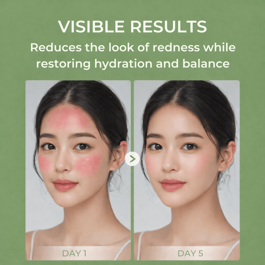 Olivine Beauty serum before and after showing reduced redness and improved skin balance