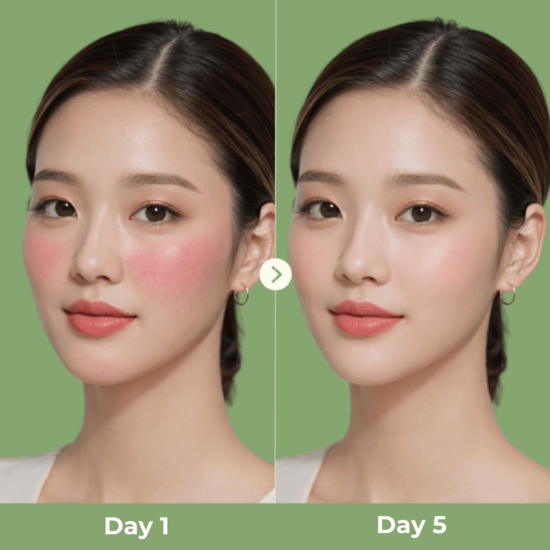 Day 1 vs Day 5 skin improvement using olivine beauty matcha toner