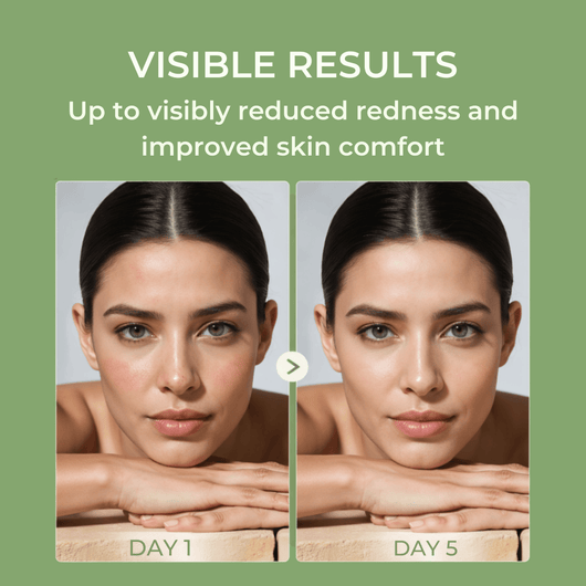 Olivine Beauty matcha toner pads before and after showing reduced redness and improved skin comfort from day 1 to day 5
