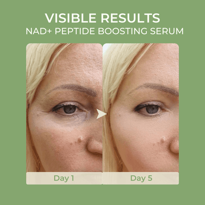 Before and after results showing smoother skin texture using Olivine Beauty NAD plus peptide boosting serum from day 1 to day 5